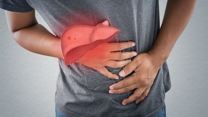 Liver Disease Liver Disease